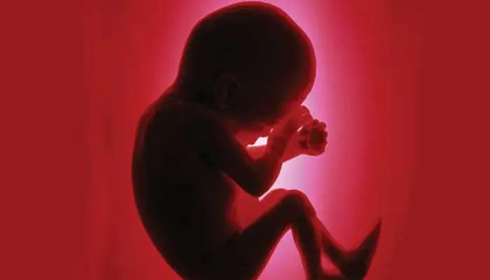 janin-2001.jpg