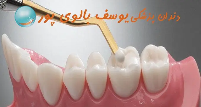 دندان