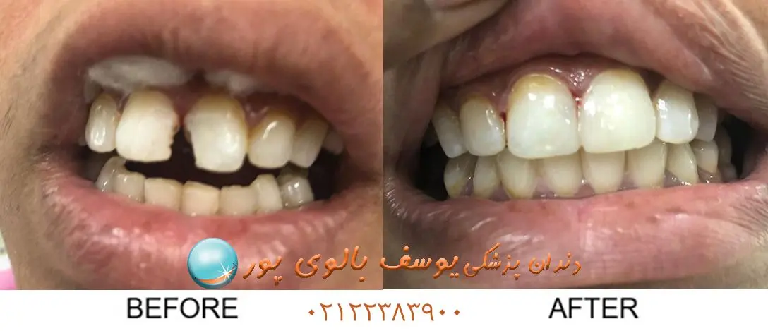 دندان ۲