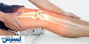 ۱۳ راهکار کاهش درد زانو