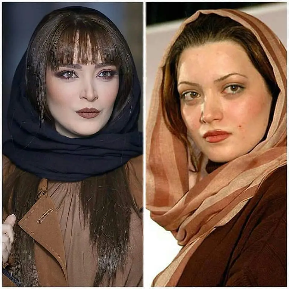 بهنوش-طباطبایی-جراحی-زیبایی