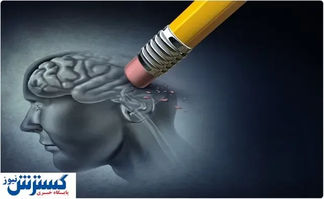 روش هایی برای کاهش ابتلا به آلزایمر