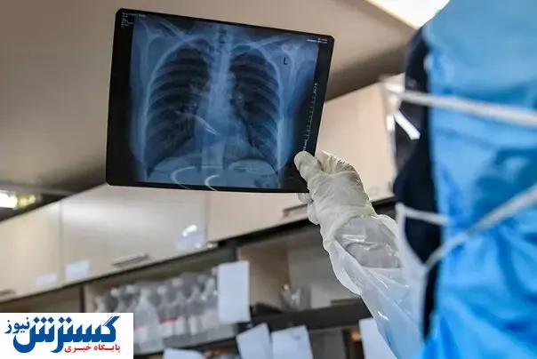کرونا با ریه های شما چه می کند؟