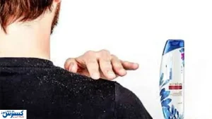 برای شامپو ضد شوره چقدر هزینه کنیم؟