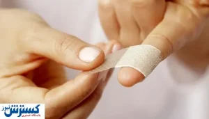 کشف مکانیسم جدید برای بهبود زخم پوست