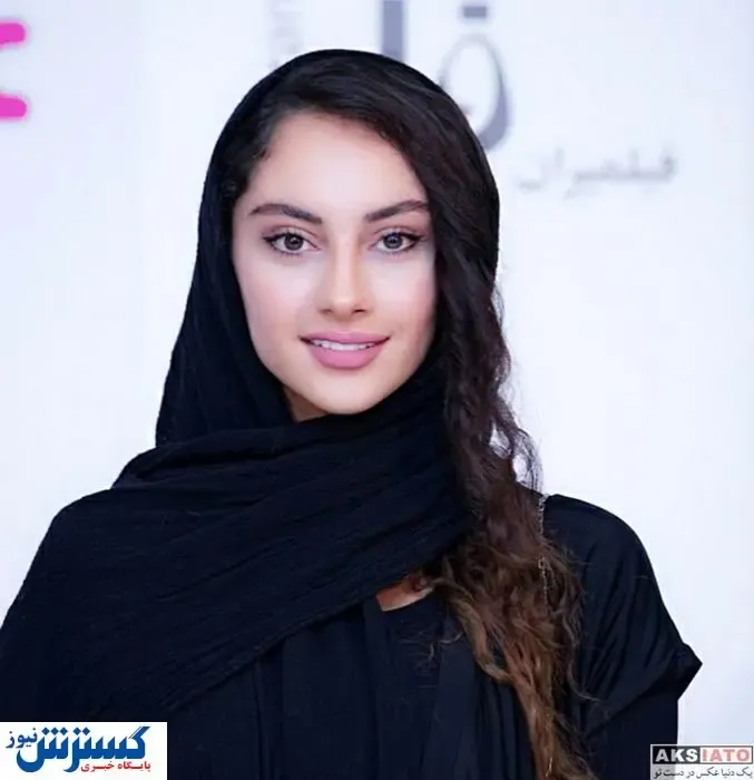 ترلان پروانه قربانی اسیدپاشی شد؟ | عکس صورت سوخته ترلان پروانه