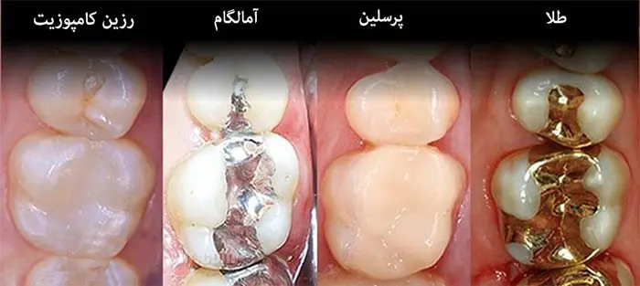 دندان