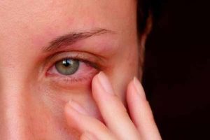 بیماری های شایع چشم را بیشتر بشناسیم!