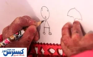 التیام بخشی برای زخم بیماران پروانه ای + جزئیات