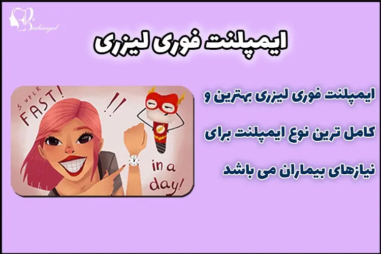 ایمپلنت-دندان-3