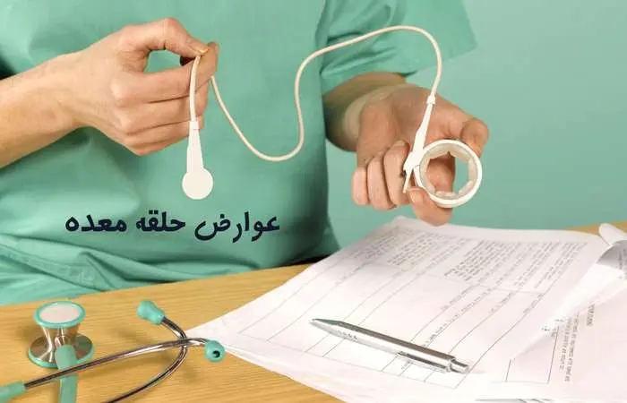 مهم ترین عوارض جراحی لاغری حلقه معده (باندینگ معده)