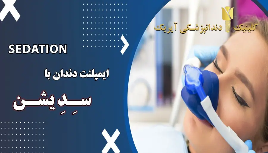 ایمپلنت دندان بدون درد-2