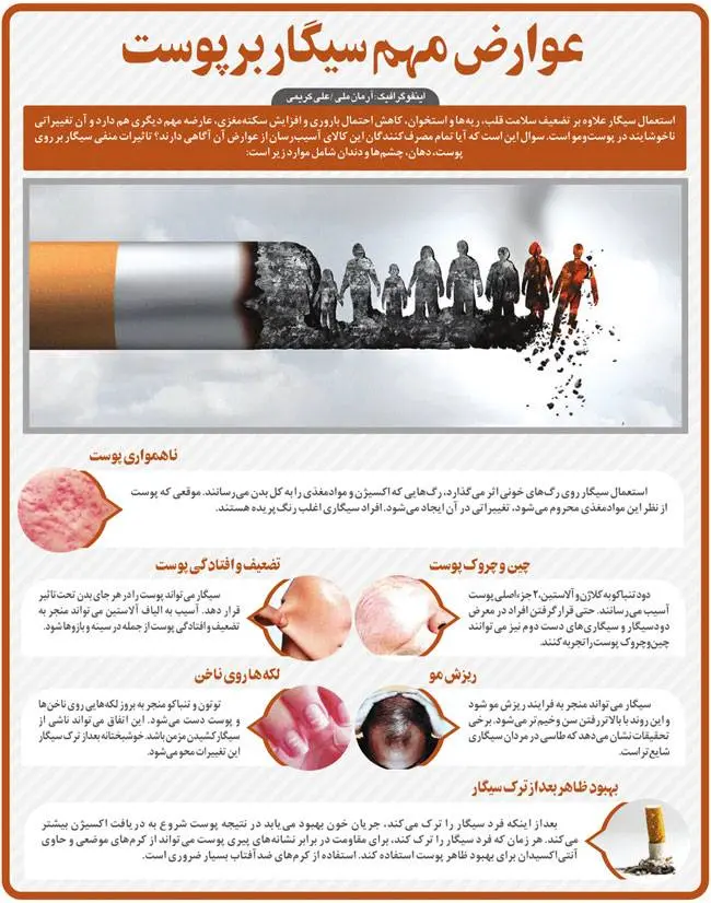 اینفوگرافیک