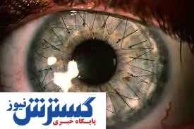 کمک سلولهای بنیادی به پایان نابینایی