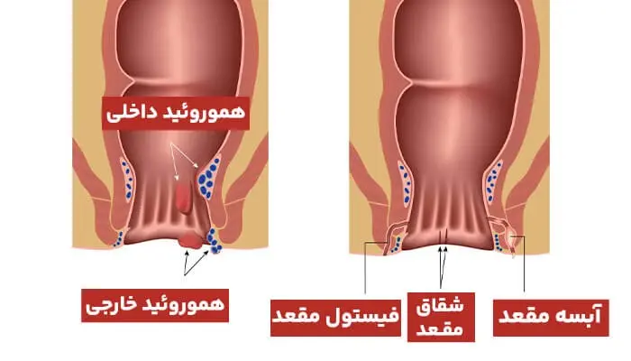 شقاق