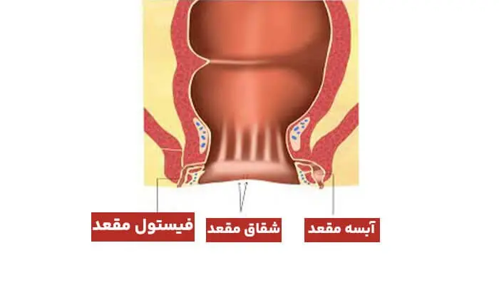 شقاق۱