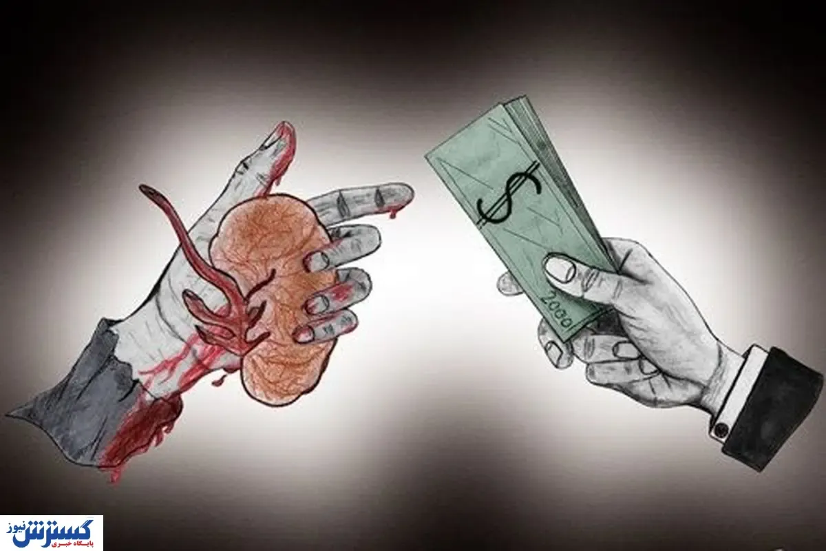 بازار سیاه فروش اعضای حیاتی بدن / دلالان درآمد دلاری دارند