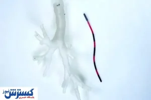 ربات انعطاف پذیر به کمک علم پزشکی در درمان سرطان ریه آمد