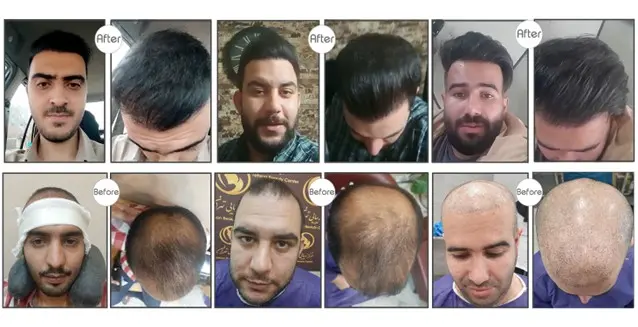 مو۲