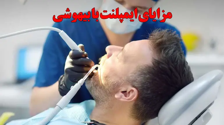 مزایای ایمپلنت با بیهوشی