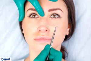 مقایسه روش های مختلف عمل بینی + معرفی بهترین روش