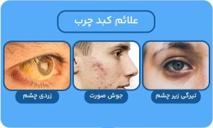 بهترین راه پاکسازی کبد در کوتاه‌ترین زمان ممکن