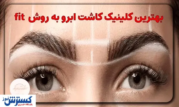 بهترین کلینیک‌های کاشت ابرو به روش FIT در تهران