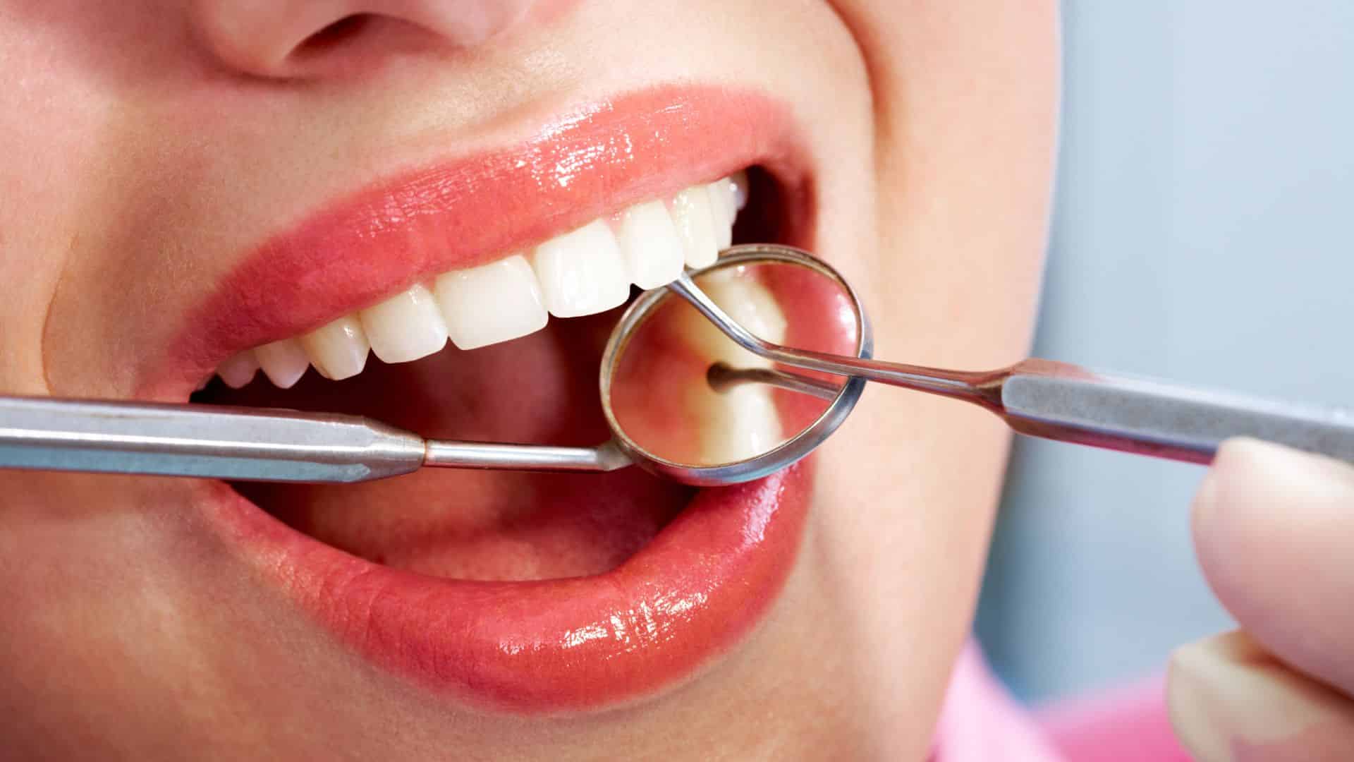 خدمات دندانپزشکی رایگان برای این افراد فعال شد؛ نوبت شماست!