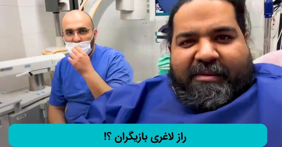 لاغری رضا صادقی