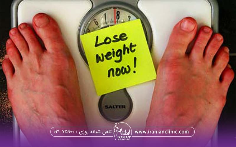 پای فردی که روی ترازو است و روی ترازو کاغذ زرد رنگ چسبیده و به انگلیسی نوشته است lose weight now!-مرکز لاغری.