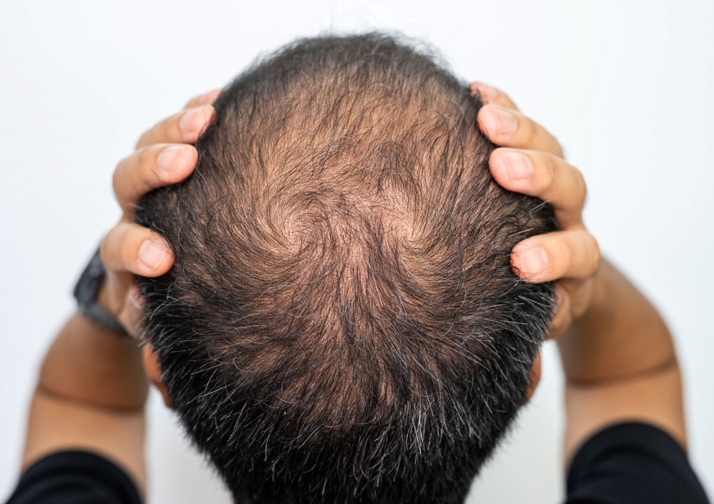 A person looking at his hair  Description automatically generated