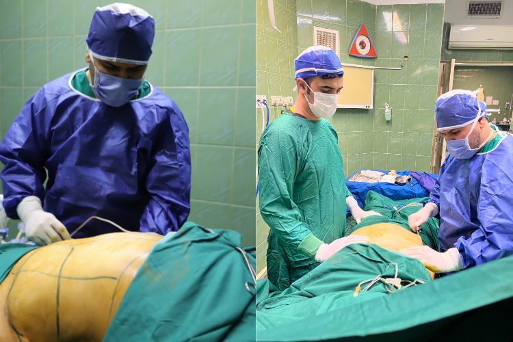 هزینه عمل لاغری در تهران